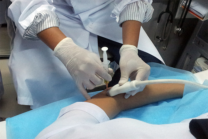 Chữa viêm gân tay mãn tính bằng phương pháp mới