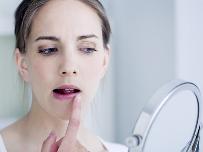 4 nguyên nhân gây khô nứt môi và cách chữa lành