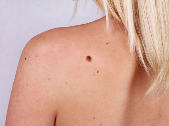 5 biểu hiện trên mặt và da 'tố cáo' tình trạng sức khỏe của bạn