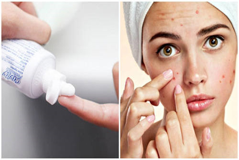 10 lợi ích bất ngờ từ kem đánh răng, bà nội trợ nên biết