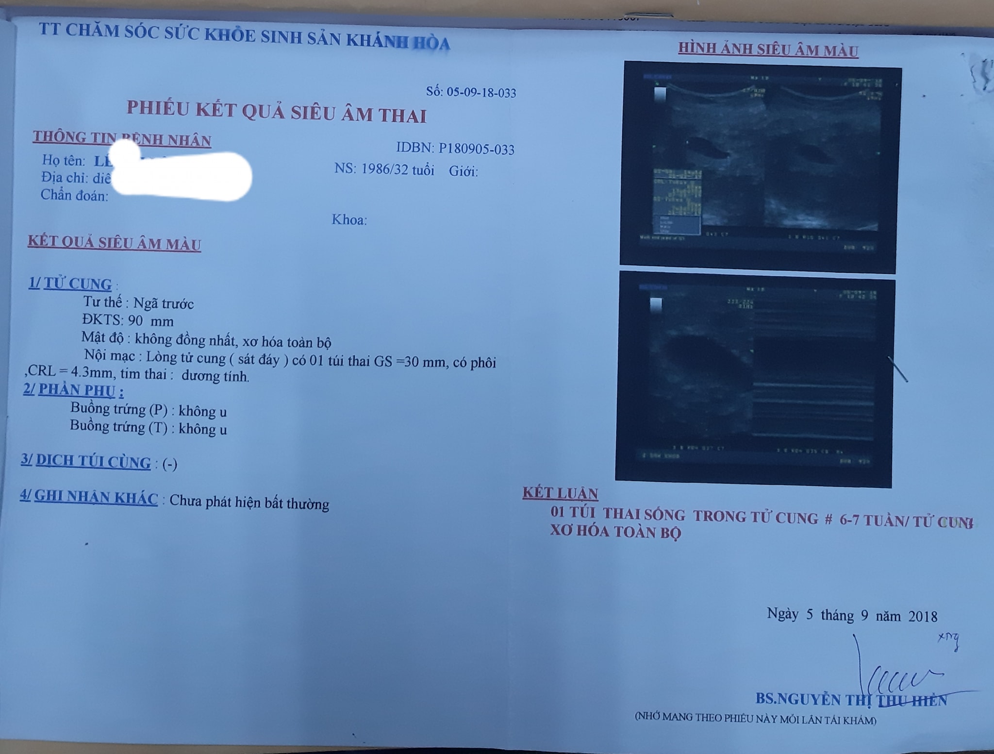 Mổ thành công lấy thai nhi ra khỏi khối nhân xơ lớn