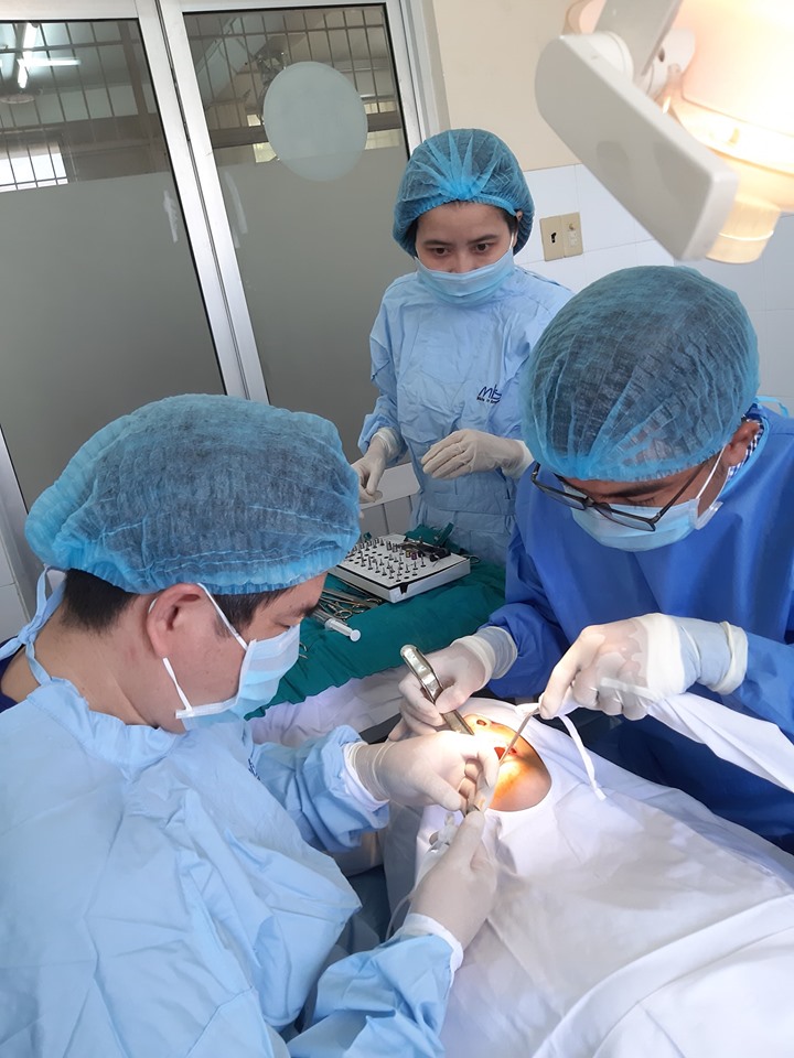 Bệnh viện Đa khoa tỉnh tiếp nhận kỹ thuật cấy ghép răng Implant 