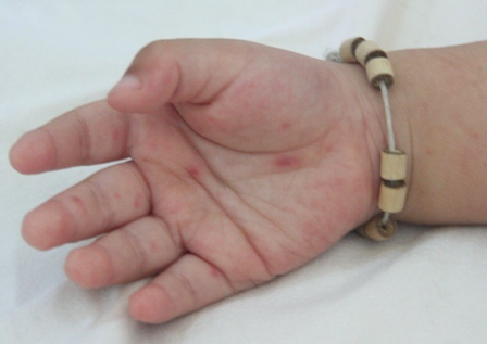 Cam Ranh: Tăng cường phòng, chống bệnh tay chân miệng