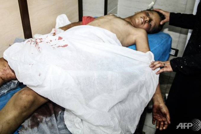 Một người bị thương nằm trong bệnh viện sau khi Aleppo bị phiến quân dội tên lửa. Ảnh: AFP
