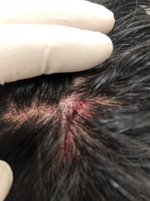 Sau khi bị hành hung, ông Hòa đã tới Bệnh viện đa khoa quốc tế Vinmec Nha Trang chữa trị.