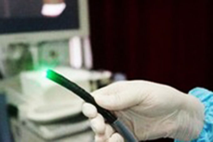 Phương pháp mới nội soi dạ dày