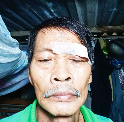 Một người dân vô cớ bị bắn