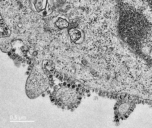 Ảnh chụp đầu tiên thể hiện nCoV nhân lên từ tế bào