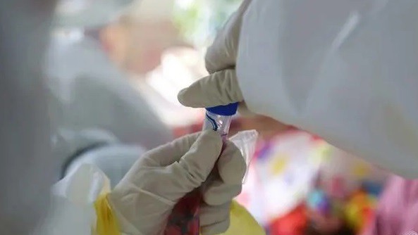 Các nhà khoa học thuộc Đại học Hoàng gia London đã bắt đầu thử nghiệm trên động vật vaccine phòng chống Covid-19. Ảnh minh họa: AFP