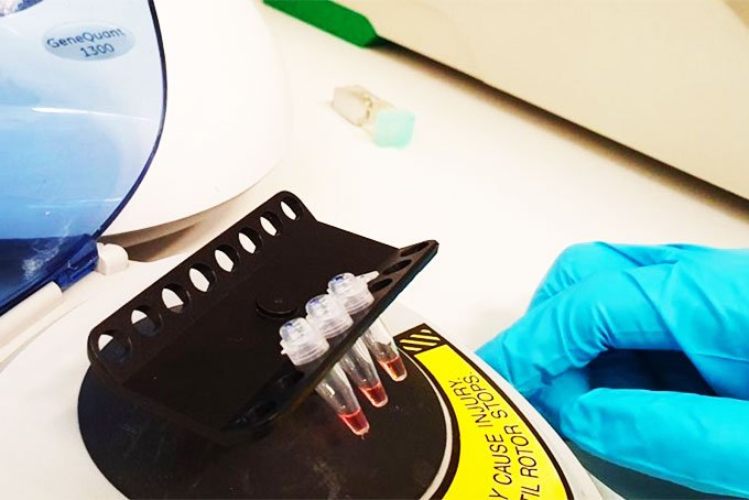 Anh phát triển kit thử nCoV cho kết quả trong 30 phút