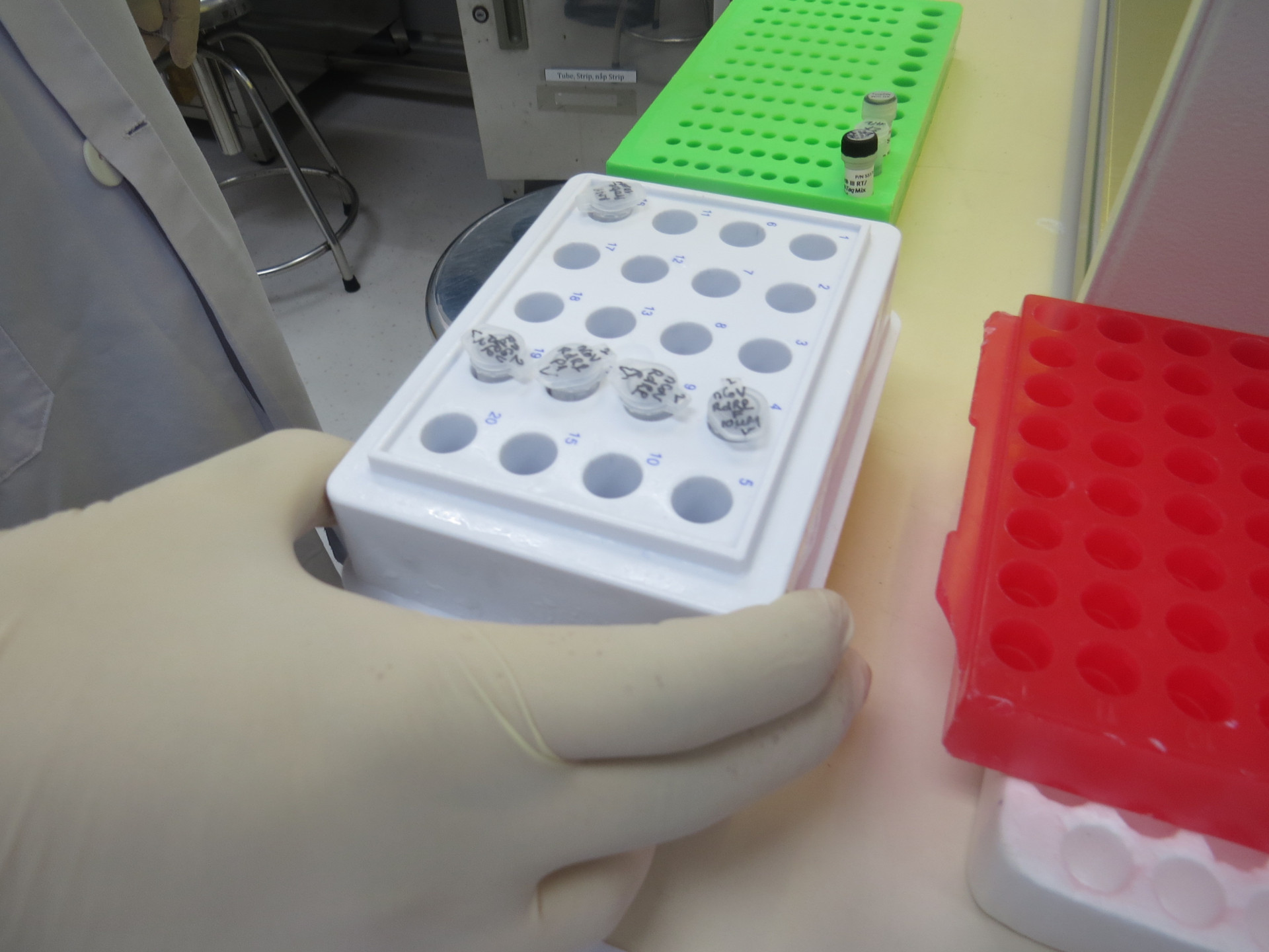Xét nghiệm vi rút SARS-CoV-2 tại VIện Pasteur Nha Trang