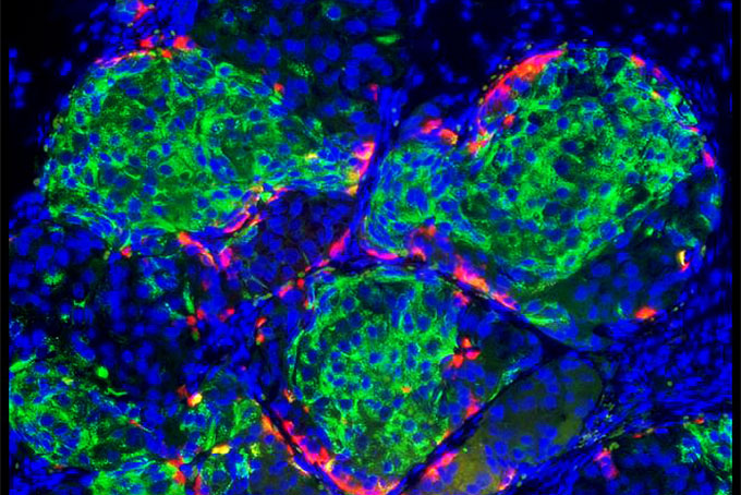 Nuôi da nhân tạo để chữa hói đầu