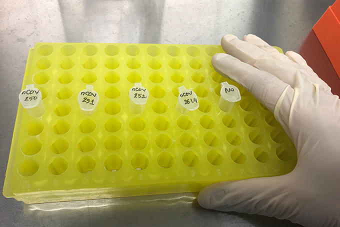 Truy vết thêm 3 F1 và 20 F2 liên quan đến bệnh nhân 13960