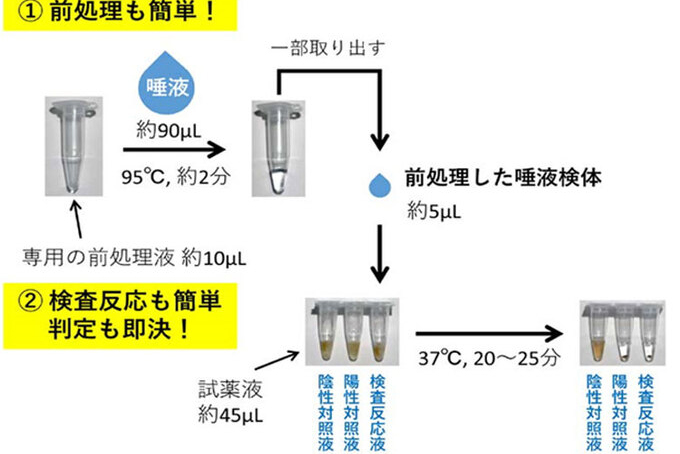 Kỹ thuật xét nghiệm nhanh nCoV từ mẫu nước bọt