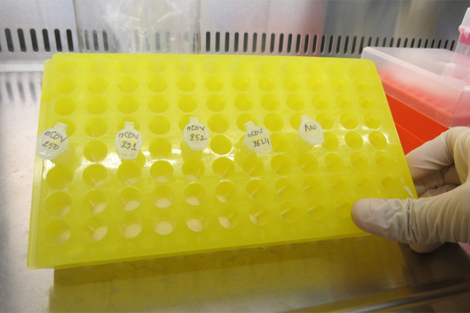 Xét nghiệm mẫu bệnh phẩm nghi ngờ Covid-19 tại Viện Pasteur Nha Trang