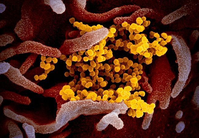 Virus SARS-CoV-2 (màu vàng) được phân lập dưới kính hiển vi điện tử. (Nguồn: Live Sicience).