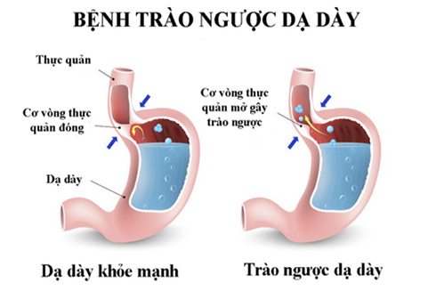 Thuốc hay chữa bệnh từ cây quít