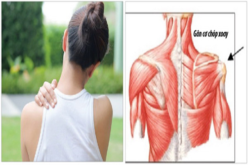 Ngừa chấn thương vai và cánh tay khi tập luyện