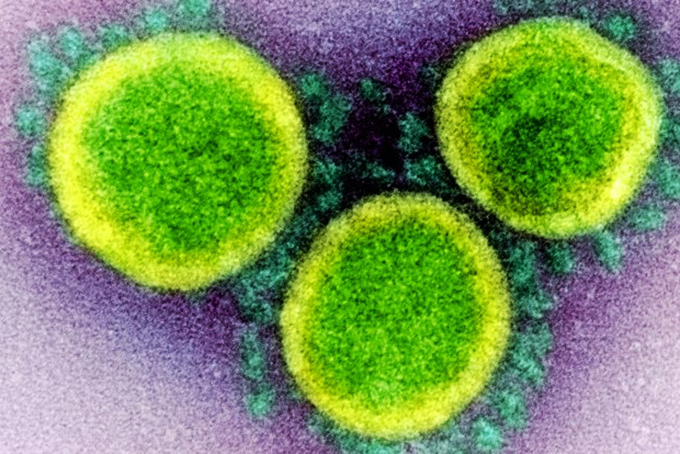 Phát hiện ra gen &quot;ẩn&quot; tinh vi trong virus SARS-CoV-2
