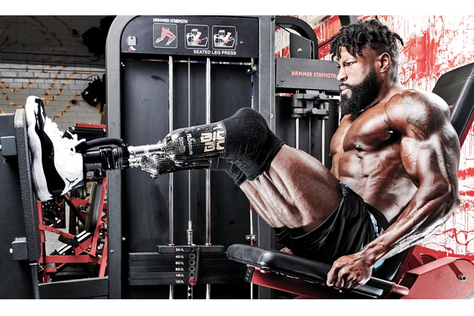 Nhà vô địch thể hình mất chân