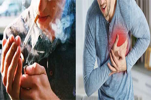 6 nguyên nhân làm tăng nguy cơ đột quỵ ở người trẻ