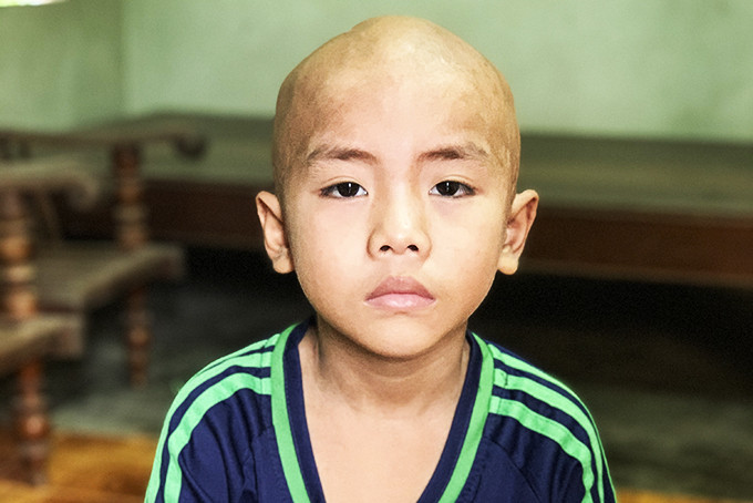 7-year-old Nguyen Anh Tuan Kiet
