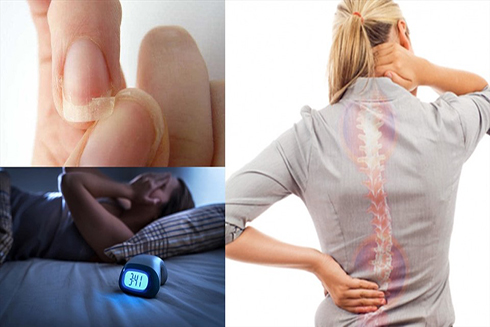 Biểu hiện khi cơ thể thiếu hụt canxi