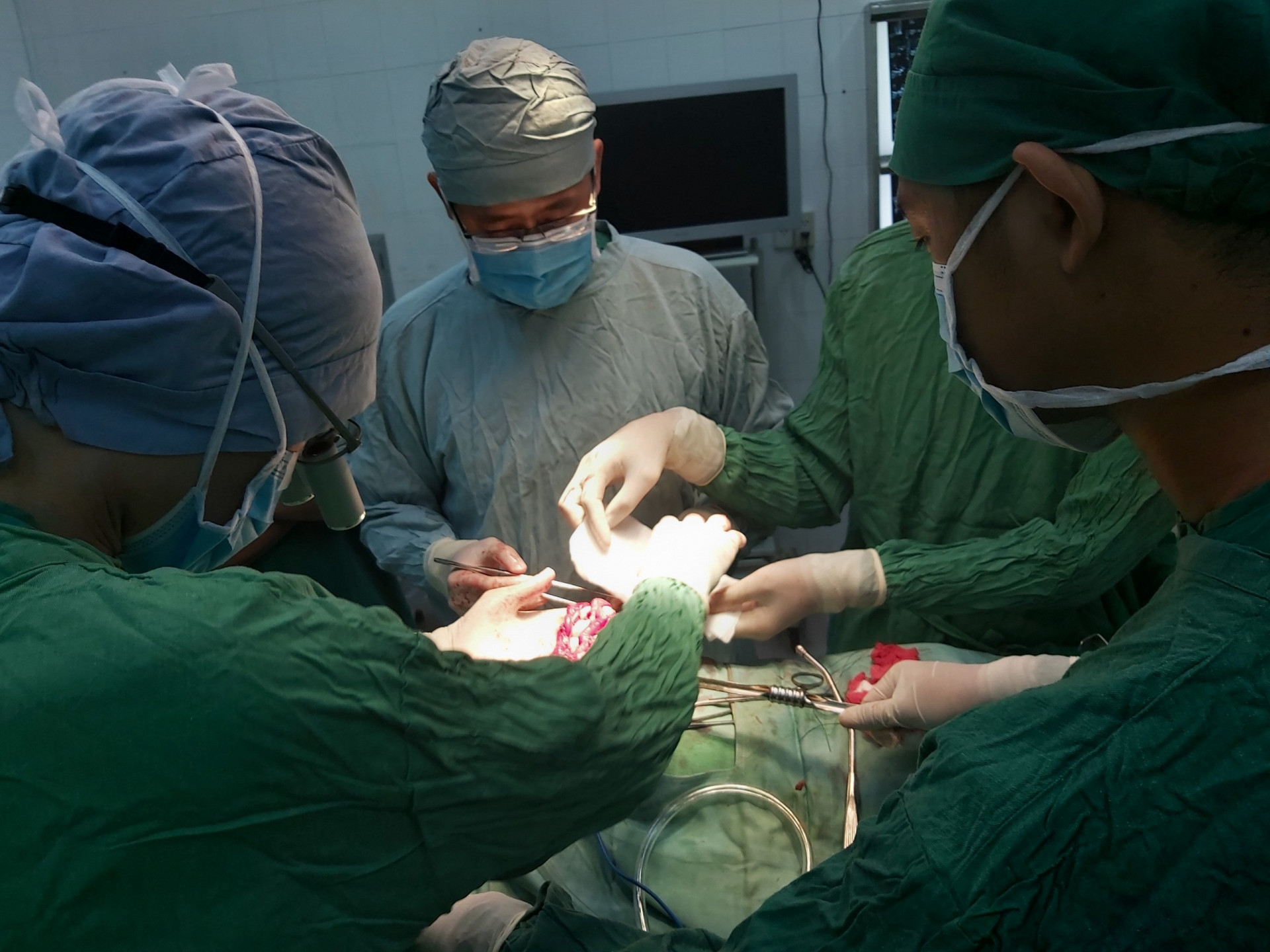 Thực hiện phẫu thuật tim hở cho bệnh nhân tại Bệnh viện Đa khoa tỉnh Khánh Hoà (ảnh minh hoa)