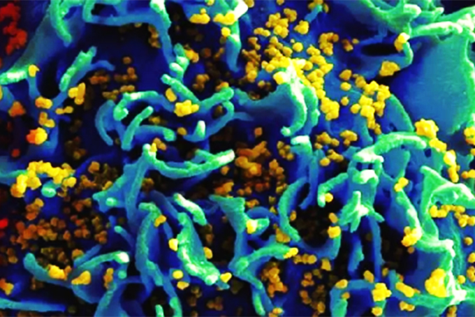 Sắp thử nghiệm lâm sàng vaccine ngừa HIV