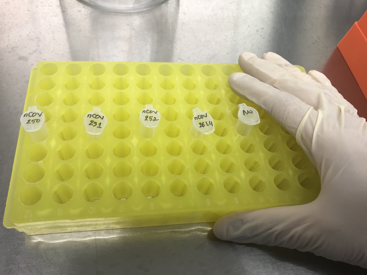 Truy vết được 11 F2 của trường hợp F1 về từ TP. Hồ Chí Minh