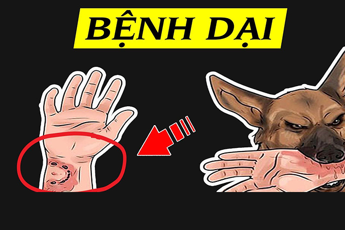 Phấn đấu không có người tử vong vì bệnh dại vào năm 2030