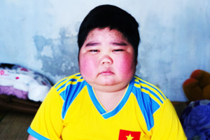 Nine-year-old boy with serious diseases