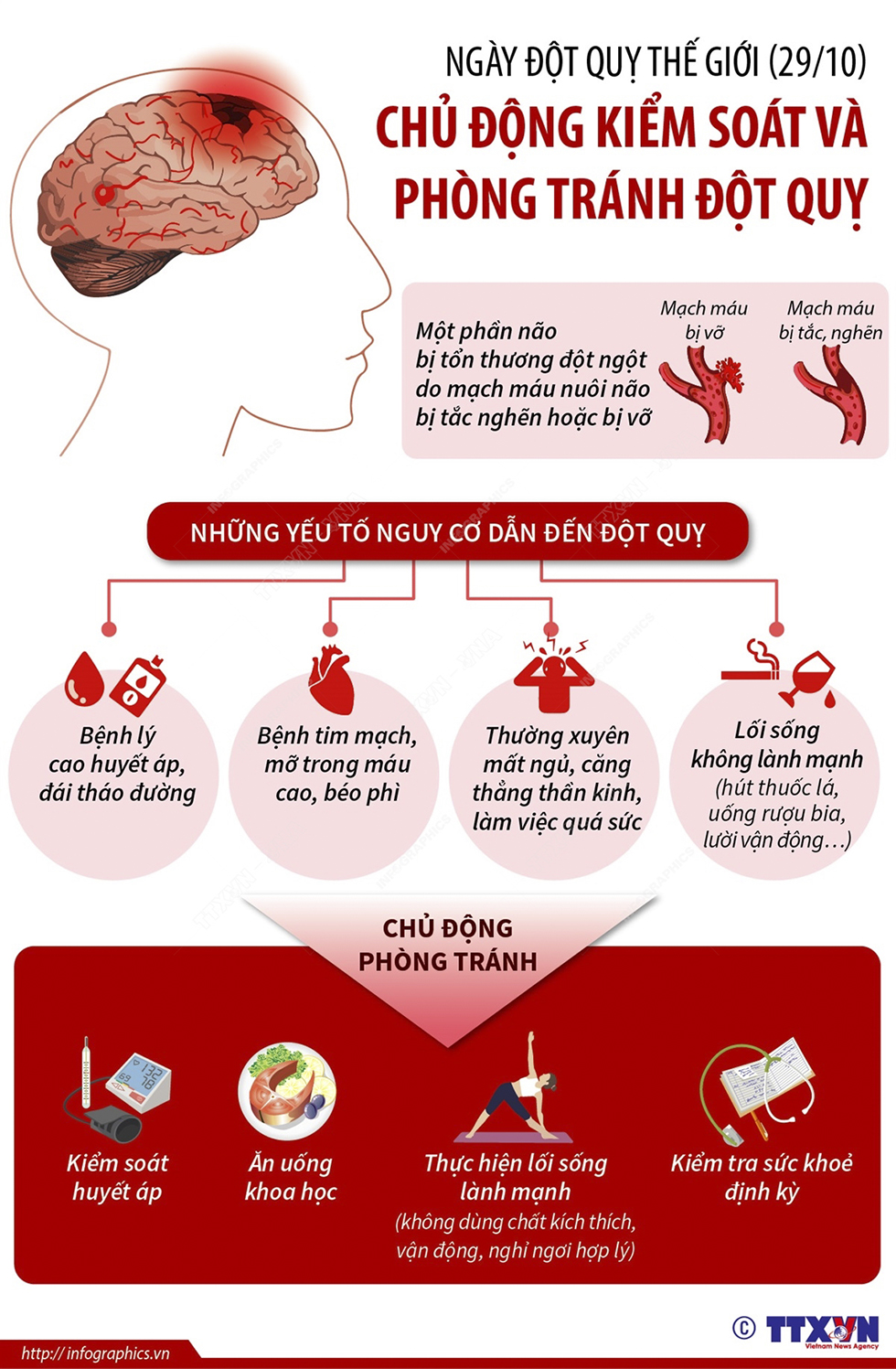 Ngày Đột quỵ thế giới (29/10): Chủ động kiểm soát và phòng tránh đột quỵ