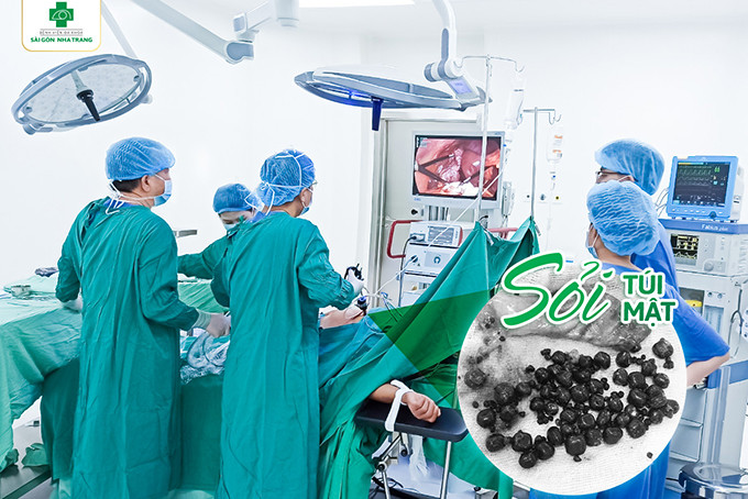 Ê-kíp y, bác sĩ Bệnh viện Đa khoa Sài Gòn Nha Trang thực hiện phẫu thuật nội soi cắt bỏ túi mật cho bệnh nhân.