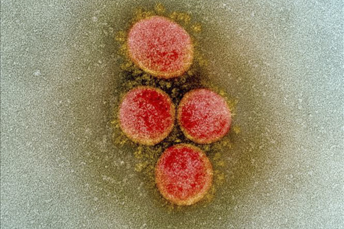 Hình ảnh từ kính hiển vi do Viện Y tế quốc gia Mỹ cung cấp cho thấy virus SARS-CoV-2 trong mẫu bệnh phẩm của bệnh nhân mắc COVID-19 ở Mỹ. Ảnh minh họa: AFP/TTXVN