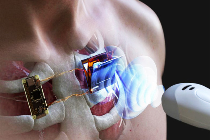 Ảnh minh họa sạc bằng sóng âm cho máy tạo nhịp tim - Ảnh: Viện Khoa học và Công nghệ Hàn Quốc