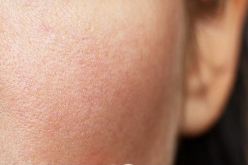 Những nguyên liệu thiên nhiên tốt nhất cho da khô