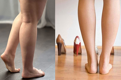 Những mẹo giảm mỡ chân hiệu quả