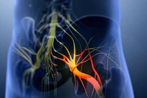 5 dấu hiệu để nhận biết cơn đau thần kinh tọa