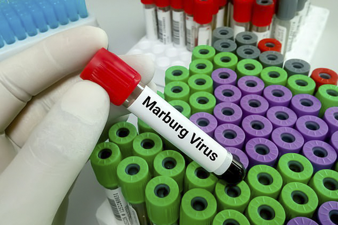 Bùng phát virus Marburg gây tử vong cao ở Tanzania